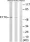 Eukaryotic Translation Elongation Factor 1 Gamma antibody, TA313785, Origene, Western Blot image 