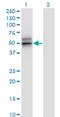 Serpin Family A Member 12 antibody, H00145264-M01, Novus Biologicals, Western Blot image 