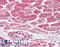 Bone Morphogenetic Protein Receptor Type 2 antibody, LS-B9506, Lifespan Biosciences, Immunohistochemistry frozen image 