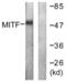 Melanocyte Inducing Transcription Factor antibody, LS-C117668, Lifespan Biosciences, Western Blot image 