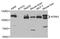 Neurotrophic Receptor Tyrosine Kinase 3 antibody, A5842, ABclonal Technology, Western Blot image 