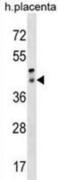 Retinal Pigment Epithelium-Derived Rhodopsin Homolog antibody, abx028960, Abbexa, Western Blot image 
