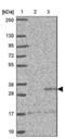 ST8SiaII antibody, NBP2-33719, Novus Biologicals, Western Blot image 