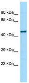 Zinc Finger Protein 69 antibody, TA339833, Origene, Western Blot image 