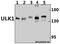Unc-51 Like Autophagy Activating Kinase 1 antibody, GTX66612, GeneTex, Western Blot image 