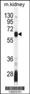 Autoimmune Regulator antibody, 55-609, ProSci, Western Blot image 