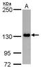 Protein Phosphatase 1 Regulatory Subunit 3A antibody, GTX128215, GeneTex, Western Blot image 