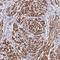 Neuroepithelial Cell Transforming 1 antibody, NBP2-13653, Novus Biologicals, Immunohistochemistry frozen image 