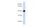 Forkhead Box L1 antibody, 27-119, ProSci, Western Blot image 