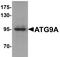 Autophagy Related 9A antibody, AHP2248, Bio-Rad (formerly AbD Serotec) , Enzyme Linked Immunosorbent Assay image 