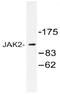 Janus Kinase 2 antibody, AP20496PU-N, Origene, Western Blot image 