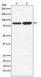 Histone acetyltransferase KAT2B antibody, M02403, Boster Biological Technology, Western Blot image 