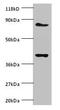 NADH:Ubiquinone Oxidoreductase Subunit S5 antibody, orb242269, Biorbyt, Western Blot image 