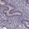 Melanoma-associated antigen 4 antibody, HPA021942, Atlas Antibodies, Immunohistochemistry frozen image 