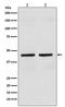 Keratin 18 antibody, M01357-1, Boster Biological Technology, Western Blot image 