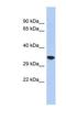 Cellular Repressor Of E1A Stimulated Genes 2 antibody, NBP1-70509, Novus Biologicals, Western Blot image 