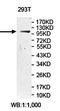 Ubiquitin carboxyl-terminal hydrolase 35 antibody, orb78283, Biorbyt, Western Blot image 