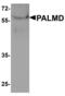 Palmdelphin antibody, LS-C358493, Lifespan Biosciences, Western Blot image 