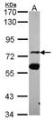 Zinc Finger Protein 74 antibody, NBP2-21047, Novus Biologicals, Western Blot image 