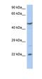Putative zinc finger protein 826 antibody, orb325582, Biorbyt, Western Blot image 