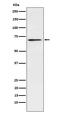 Lymphocyte Cytosolic Protein 1 antibody, M03361-2, Boster Biological Technology, Western Blot image 