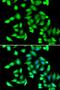 Glutathione S-transferase C-terminal domain-containing protein antibody, LS-C346263, Lifespan Biosciences, Immunofluorescence image 
