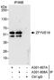 Zinc finger FYVE domain-containing protein 19 antibody, A301-807A, Bethyl Labs, Immunoprecipitation image 