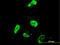 Promyelocytic Leukemia antibody, LS-C197930, Lifespan Biosciences, Immunofluorescence image 