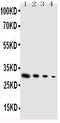 Glial Cell Derived Neurotrophic Factor antibody, PA1465, Boster Biological Technology, Western Blot image 