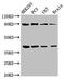 Tripartite Motif Containing 54 antibody, LS-C679894, Lifespan Biosciences, Western Blot image 