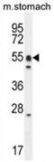 Doublesex- and mab-3-related transcription factor A1 antibody, AP51280PU-N, Origene, Western Blot image 