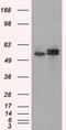 ATP Synthase F1 Subunit Beta antibody, TA500834, Origene, Western Blot image 