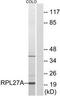 Ribosomal Protein L27a antibody, TA314465, Origene, Western Blot image 