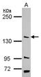 Poly(A) Specific Ribonuclease Subunit PAN2 antibody, NBP2-15062, Novus Biologicals, Western Blot image 