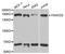 FA Complementation Group D2 antibody, STJ23624, St John