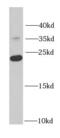 Ribosomal Protein S7 antibody, FNab07484, FineTest, Western Blot image 