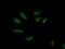 AP2M1 antibody, MA5-25571, Invitrogen Antibodies, Immunocytochemistry image 