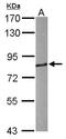 Hedgehog Interacting Protein antibody, LS-C186277, Lifespan Biosciences, Western Blot image 