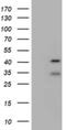 Ubiquitin carboxyl-terminal hydrolase 12 antibody, NBP2-46298, Novus Biologicals, Western Blot image 