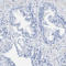 Hedgehog Acyltransferase Like antibody, HPA018174, Atlas Antibodies, Immunohistochemistry paraffin image 