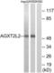 5-Phosphohydroxy-L-Lysine Phospho-Lyase antibody, LS-C119703, Lifespan Biosciences, Western Blot image 