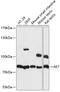 Adenylate Kinase 7 antibody, GTX66272, GeneTex, Western Blot image 