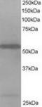 HIP-55 antibody, TA302793, Origene, Western Blot image 