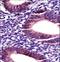 Matrix Metallopeptidase 17 antibody, LS-C164239, Lifespan Biosciences, Immunohistochemistry frozen image 