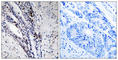 Histone Cluster 1 H2A Family Member M antibody, abx012955, Abbexa, Western Blot image 