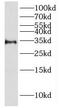 Hydroxysteroid 17-Beta Dehydrogenase 6 antibody, FNab04027, FineTest, Western Blot image 