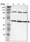 Isocitrate dehydrogenase [NAD] subunit gamma, mitochondrial antibody, PA5-51385, Invitrogen Antibodies, Western Blot image 