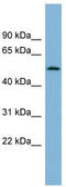 CCR4-NOT Transcription Complex Subunit 11 antibody, TA344994, Origene, Western Blot image 
