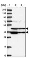 Proteasomal ATPase Associated Factor 1 antibody, NBP1-82310, Novus Biologicals, Western Blot image 