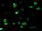 Myocyte Enhancer Factor 2C antibody, NBP2-00493, Novus Biologicals, Immunocytochemistry image 